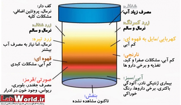 رنگ ادرار و اسرار درون بدنتان