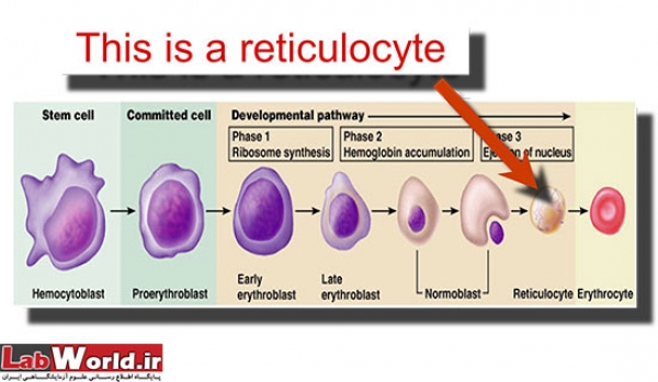 آزمايش شمارش رتيکولوسيت