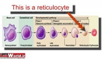 آزمايش شمارش رتيکولوسيت