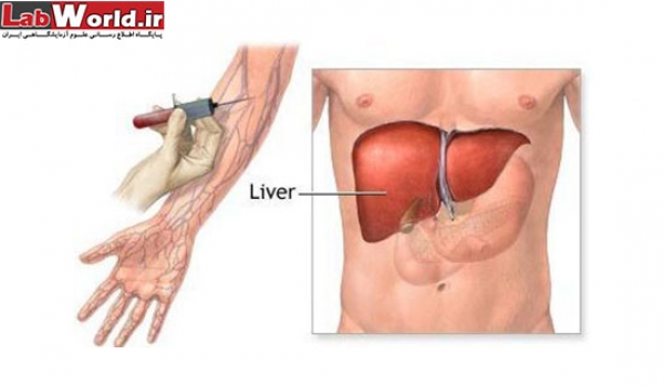 اهداف آزمایشات SGPT و SGOT